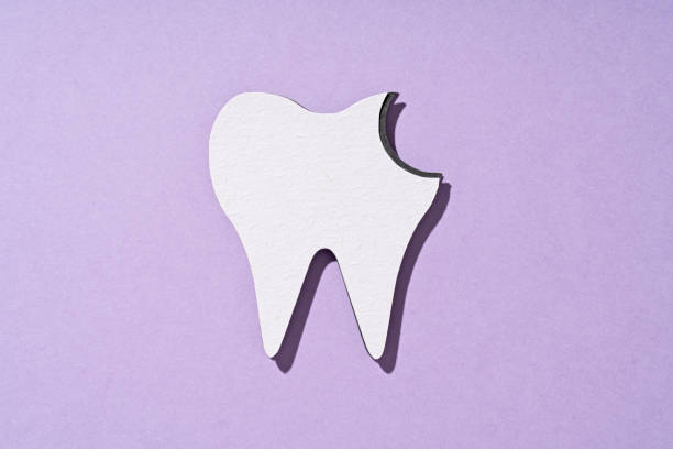 Understanding the Salon Care 40 Method for Teeth Whitening